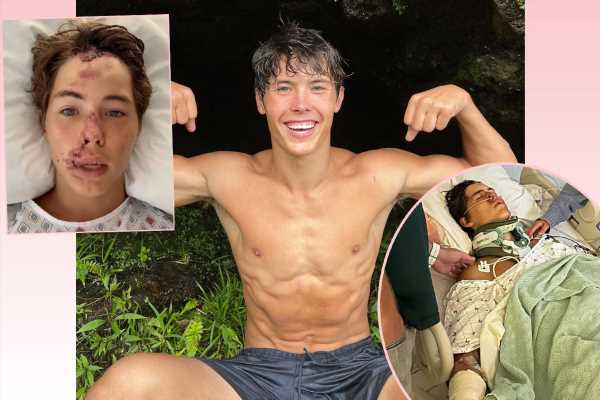 TikTok Star Caleb Coffee In ICU After Falling From ‘60 To 80-Foot’ Cliff In Hawaii